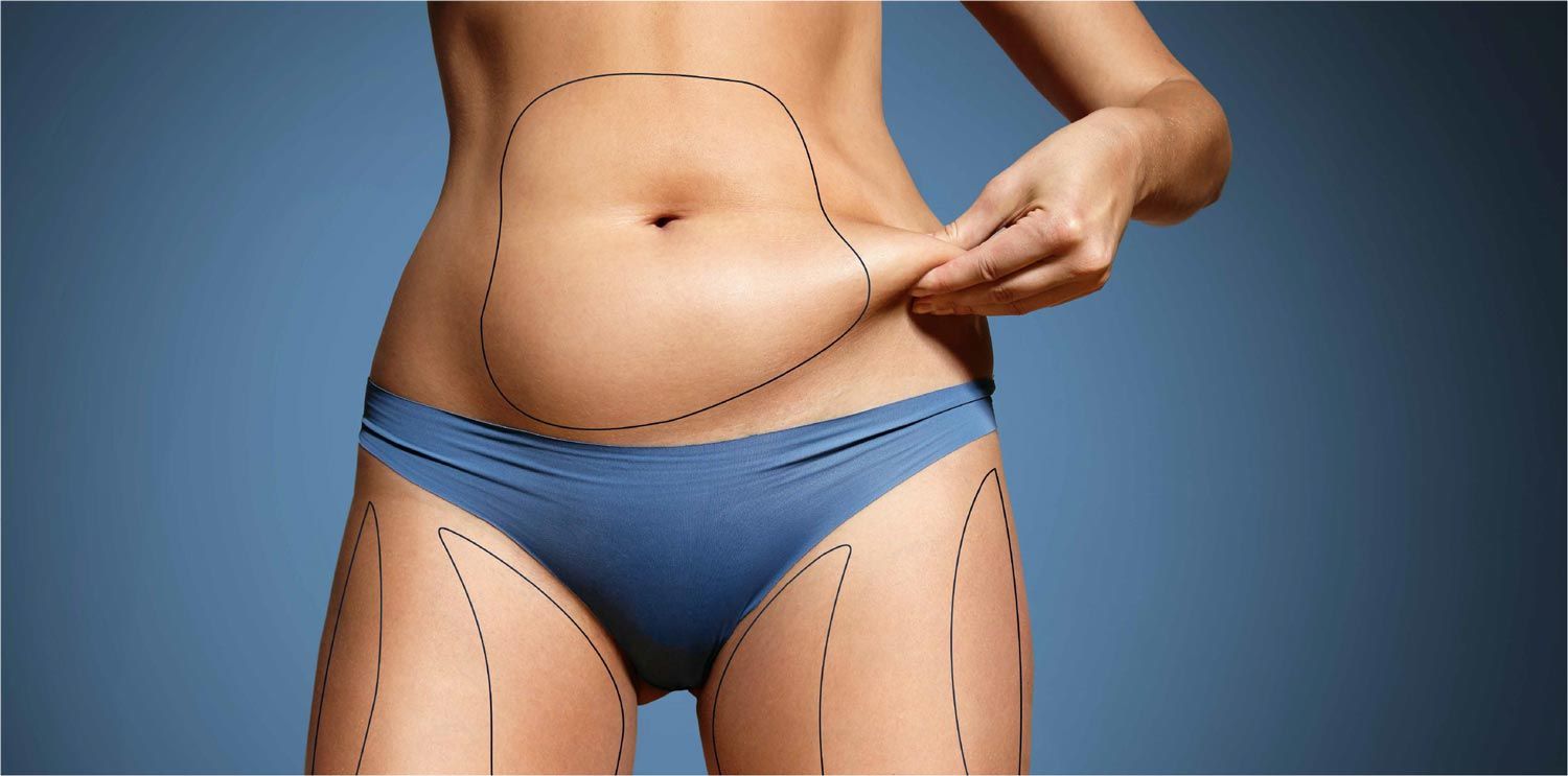 Benefits of 360 Liposuction Dubai for Full Body Contouring