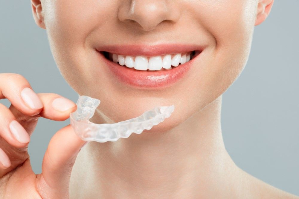 Invisalign Dubai: A Complete Guide for Beginners